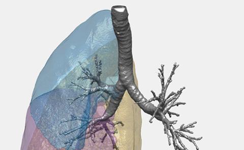 Image of a lung